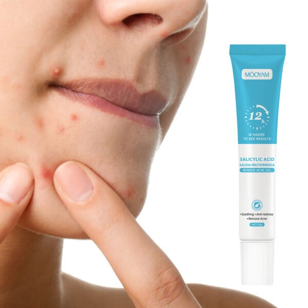 Mooyam Salicylic Acid Remove Acne Gel 20+20 gm (২ পিস ফুল কোর্স) - Image 3